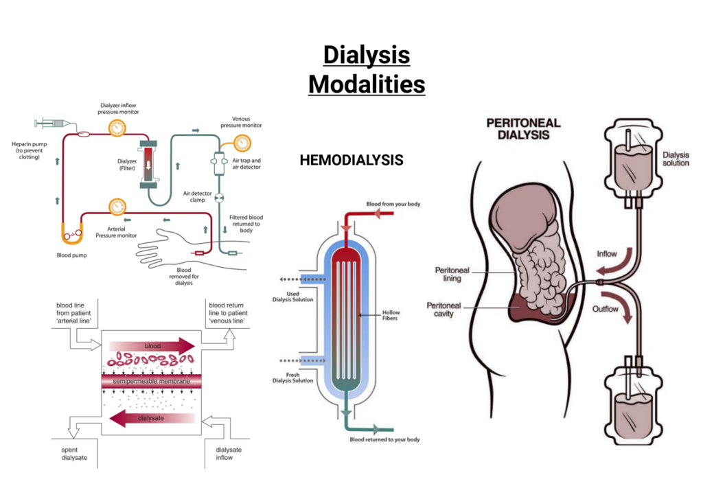 A graphic showcasing both dialysis modalities