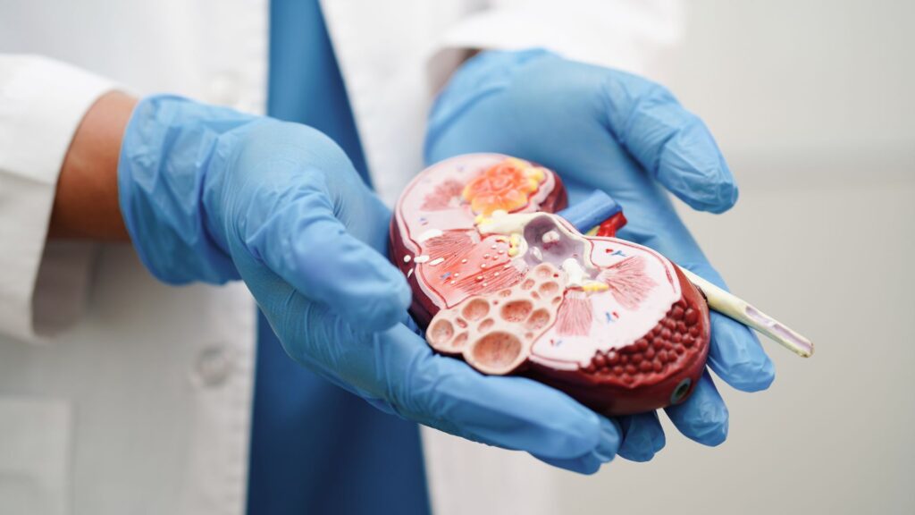 Doctor holding model kidney explaining hyperfiltration
